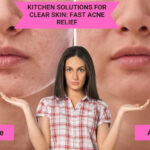 Kitchen Solutions for Clear Skin Fast Acne Relief