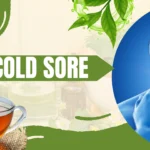 Natural remedies for cold sores