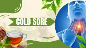 Natural remedies for cold sores