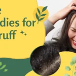 Natural dandruff treatments at home