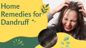 Natural dandruff treatments at home